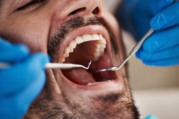 Best Emergency Treatment for Dental Infections or Abscesses in , MO
